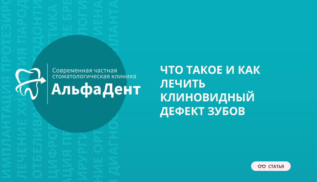 Что такое и как лечить клиновидный дефект зубов – Стоматология ...