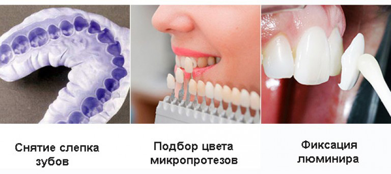 Установка люминиров
