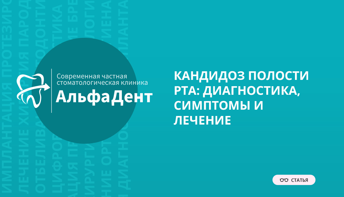 Кандидоз полости рта: диагностика, симптомы и лечение – Стоматология  «АльфаДент» в Оренбурге