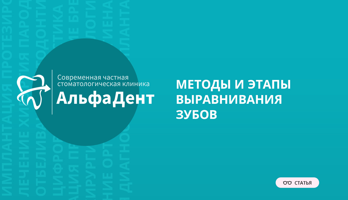 Методы и этапы выравнивания зубов – Стоматология «АльфаДент» в Оренбурге