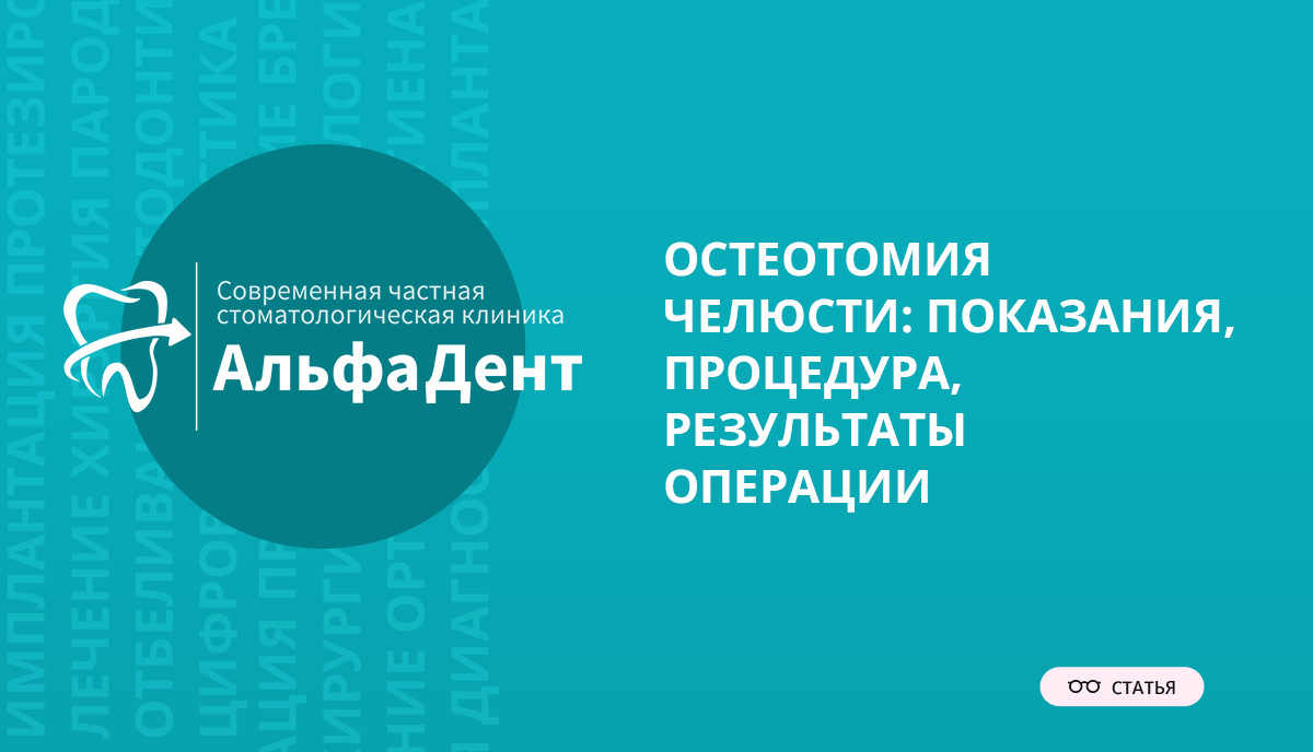 Остеотомия челюсти: показания, процедура, результаты операции –  Стоматология «АльфаДент» в Оренбурге