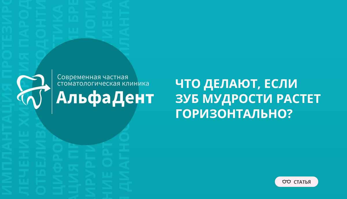 Что делают, если зуб мудрости растет горизонтально? – Стоматология  «АльфаДент» в Оренбурге