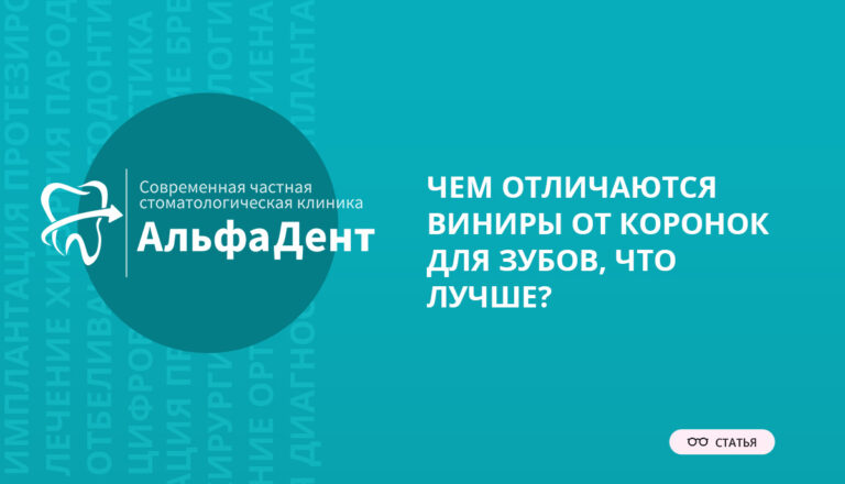 Чем отличаются виниры от коронок для зубов, что лучше?