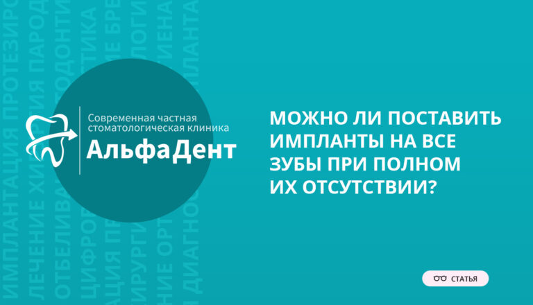 mozhno-li-postavit-implanty-na-vse-zuby-pri-polnom-ih-otsutstvii